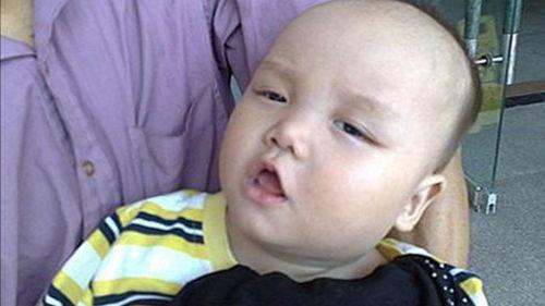 吃瓜舌头疼多久,吃瓜引发的短暂不适